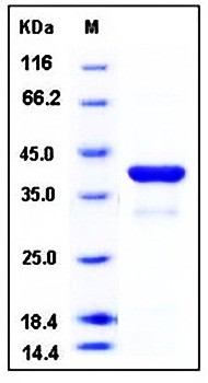SDS-PAGE analysis of Human NFKBIA His tag protein
