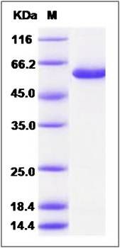 SDS-PAGE analysis of Human PNLIPRP2 protein (His Tag)