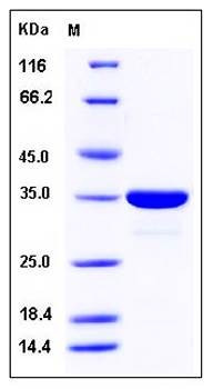 SDS-PAGE analysis of human ACYP2 GST tag protein