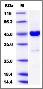 SDS-PAGE analysis of human SRI protein (GST Tag)