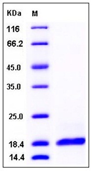 SDS-PAGE analysis of Human PLA2G2A His tag protein