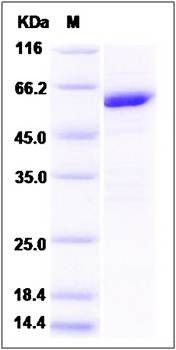 SDS-PAGE analysis of Human KLHL2 protein (GST Tag)
