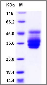SDS-PAGE analysis of Human IFITM3 protein
