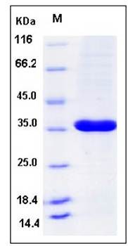 SDS-PAGE analysis of Human PCNA protein (His Tag)