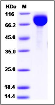 SDS-PAGE analysis of human AFM protein (His Tag)
