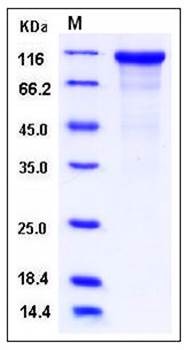 SDS-PAGE analysis of human CDH17 His tag protein