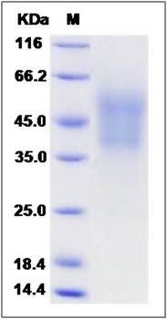 SDS-PAGE analysis of Mouse MCSF protein (His Tag)