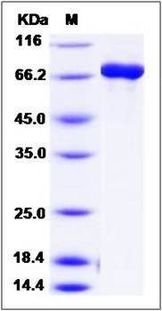 SDS-PAGE analysis of human DPYS protein (GST Tag)