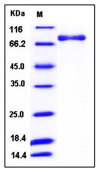 SDS-PAGE analysis of Human PDE1B His GST tag protein
