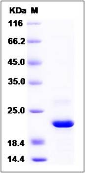 SDS-PAGE analysis of human ARL2BP protein (His Tag)