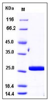 SDS-PAGE analysis of human CRADD His tag protein