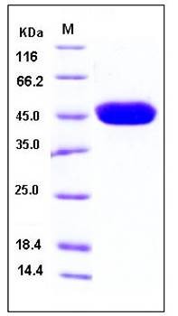 SDS-PAGE analysis of human CA14 His tag protein