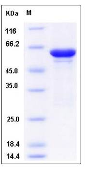 SDS-PAGE analysis of human ALDOB protein GST Tag