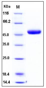 SDS-PAGE analysis of human CHIT1 His tag protein