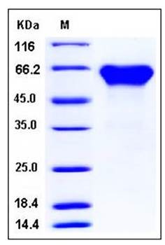 SDS-PAGE analysis of mouse ACVR2A Fc His tag protein