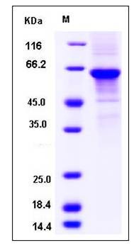 SDS-PAGE analysis of human DKKL1 protein
