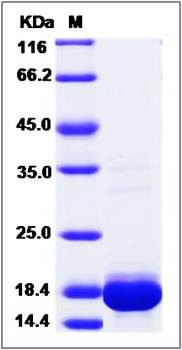 SDS-PAGE analysis of THEM2 (His Tag) protein