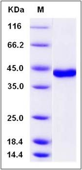 SDS-PAGE analysis of Human USP46 protein