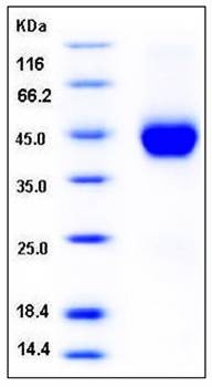 SDS-PAGE analysis of human Cystatin F His tag protein