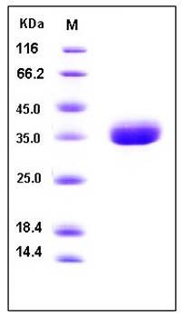 SDS-PAGE analysis of human AZU1 His tag protein