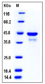 SDS-PAGE analysis of human SULT2B1 His tag protein