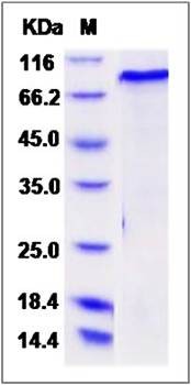 SDS-PAGE analysis of mouse Smad2 protein (GST Tag)