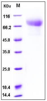 SDS-PAGE analysis of human CADM1 His tag protein