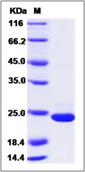 SDS-PAGE analysis of human GKN1 protein (His Tag)
