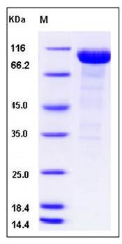 SDS-PAGE analysis of human ALPI protein