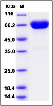 SDS-PAGE analysis of Human MSLN protein