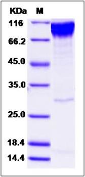 SDS-PAGE analysis of human ECD protein (GST Tag)