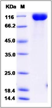 SDS-PAGE analysis of Rat VEGFR1 protein (His Tag)