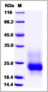 SDS-PAGE analysis of mouse GM-CSF protein (His Tag)