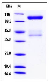 SDS-PAGE analysis of canine c-MET His tag protein