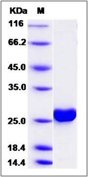 SDS-PAGE analysis of human CMPK1 protein (His Tag)