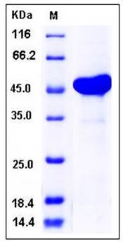 SDS-PAGE analysis of human AK3L1 His GST tag protein
