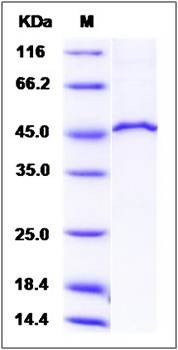 SDS-PAGE analysis of Human MVK protein (GST Tag)