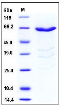 SDS-PAGE analysis of Human PHKG1 GST tag protein
