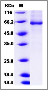 SDS-PAGE analysis of human BBOX1 protein (GST Tag)
