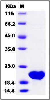 SDS-PAGE analysis of Mouse OSM protein (Native)