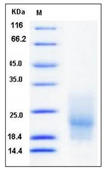 SDS-PAGE analysis of human CD63 His tag protein