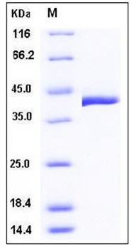 SDS-PAGE analysis of mouse TCN2 His tag protein