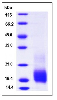 SDS-PAGE analysis of human TIGIT His tag protein