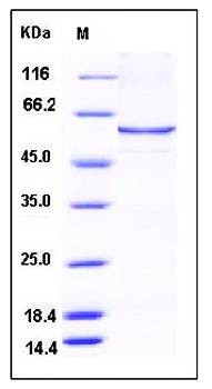 SDS-PAGE analysis of human CAT protein (His Tag)