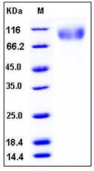 SDS-PAGE analysis of human CEACAM5 His tag protein