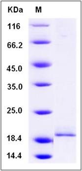 SDS-PAGE analysis of Human PPP3R1 protein (His Tag)