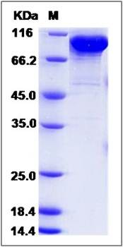 SDS-PAGE analysis of human FSTL5 protein (His Tag)