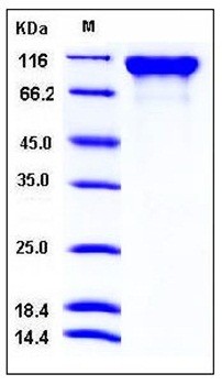 SDS-PAGE analysis of Mouse SEMA4D His tag protein