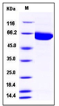 SDS-PAGE analysis of Human PAK3 His tag protein