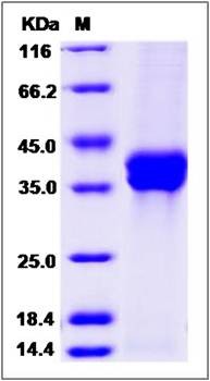 SDS-PAGE analysis of human STC2 protein (His Tag)